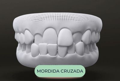 mordida - oralfy catanduva - dentista (2)