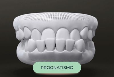 mordida - oralfy catanduva - dentista (3)