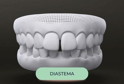 mordida - oralfy catanduva - dentista (4)