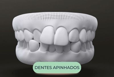 mordida - oralfy catanduva - dentista (6)