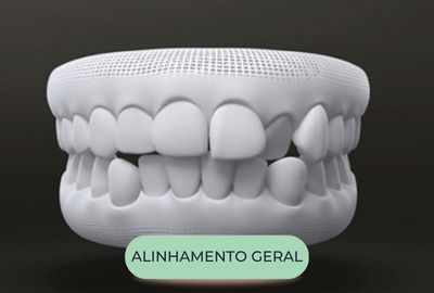 mordida - oralfy catanduva - dentista (7)